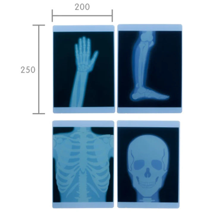 Human Body X-Ray Film 4pc Set by Masterkidz Early Science STEM Toys 4yrs+