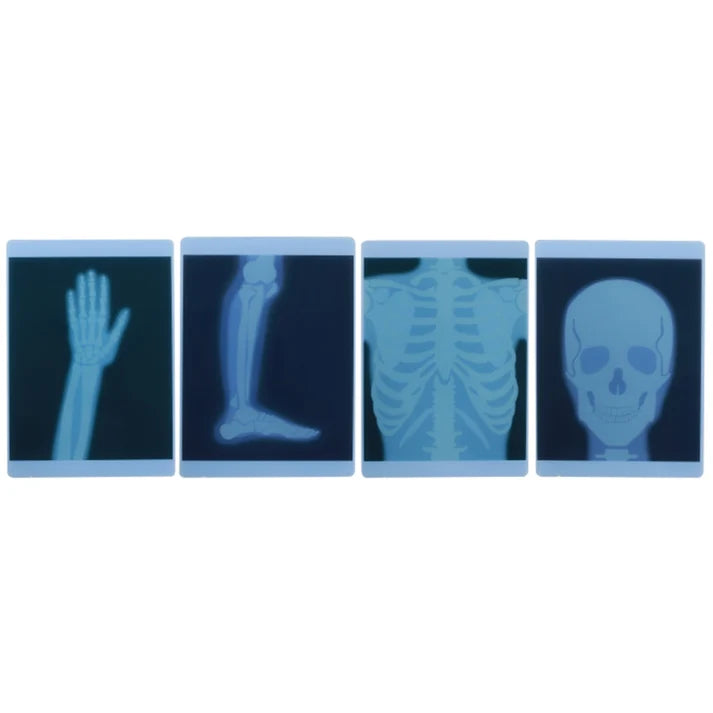 Human Body X-Ray Film 4pc Set by Masterkidz Early Science STEM Toys 4yrs+