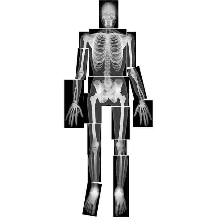 True to Life Human X-Rays 18Pc 4yrs+